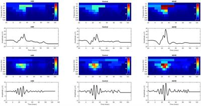 Discrete Wavelet Transform Analysis of the Electroretinogram in Autism Spectrum Disorder and Attention Deficit Hyperactivity Disorder